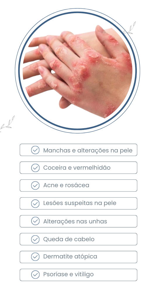 Sintomas para procurar dermatologista